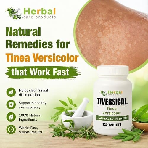 Photo shared by williamjasam: Natural Treatment for Tinea Versicolor
https://www.herbal-care-products.com/product/tinea-versicolo
