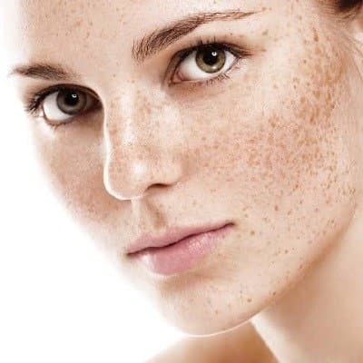 Photo shared by Perla Dermatology Clinic: Skin Pigmentation Treatment In Dubai is usually sold as a course, and the word course implies a begi