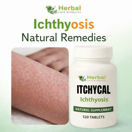 Photo shared by williamjasam: New Treatments for Ichthyosis
https://www.herbal-care-products.com/product/ichthyosis/