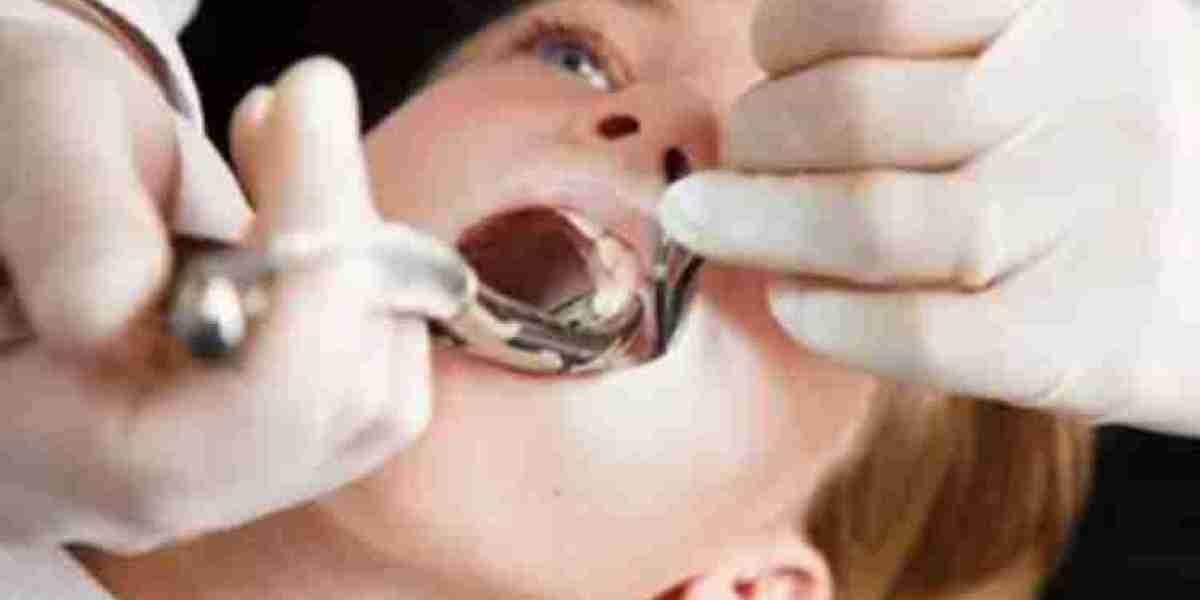 Tooth Extraction New York
