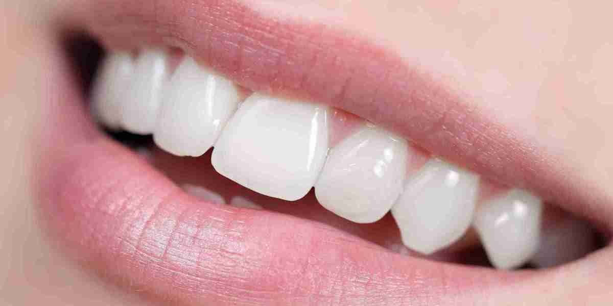 Invisalign Treatment in the UK: Benefits and How it Complements Composite Bonding