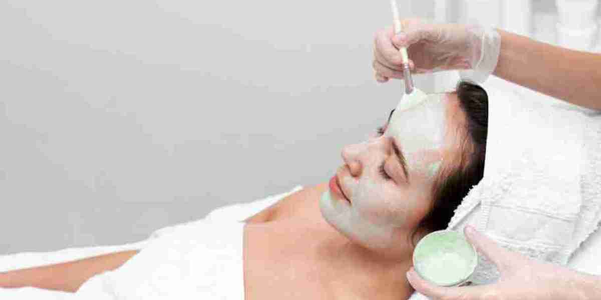 Top 5 Benefits of Chemical Peel Treatment